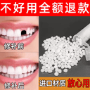进口牙材料修补神器自己补永久假牙套牙临时仿真牙齿缺牙填充修复 1