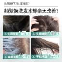 舒蕾氧活洗发水控油清凉蓬松去屑夏天去屑止痒去油 5