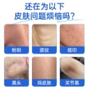维a酸乳膏医用淡化痘印去黑色素寻常痤疮粉刺闭口黑头毛囊角化H1 4