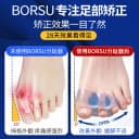德国BORSU拇指外翻脚趾矫正器硅胶分趾器大拇脚趾分离器可穿鞋套 3