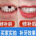 进口牙材料修补神器自己补永久假牙套牙临时仿真牙齿缺牙填充修复 2